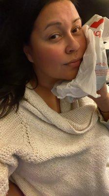 Icing my jaw to lessen the swelling like instructed
