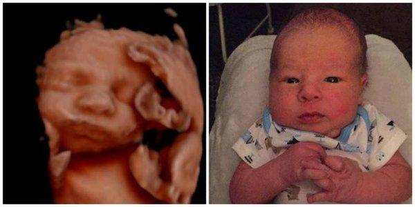 Sneak A Peek Ultrasound