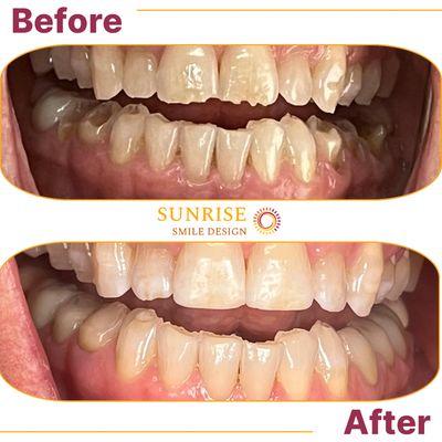 Sunrise Smile Design