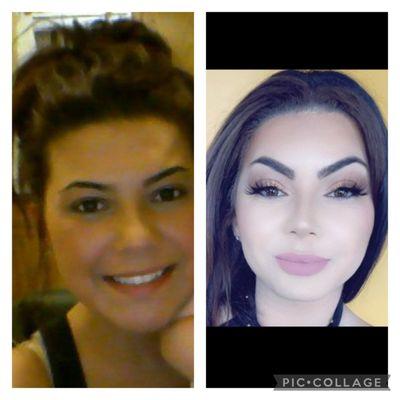 My before "no lips" photo (left) and the after (right) shows the fuller look Matthew was able to achieve!