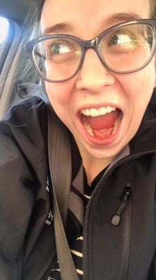 My new, beautiful, tooth colored crown!! I can laugh and be photographed again without insecurities!! thank you Sedalia Dental!!