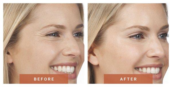 Rejuvenation & Rehydration with Nurse Azure