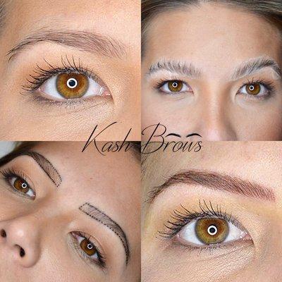 Before. Numbing. Drawing. After.