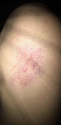 Apparently " full contact " also means we can beat u with a metal bat and you can't do S*HT about it