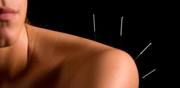 Acupuncture of Morris County
