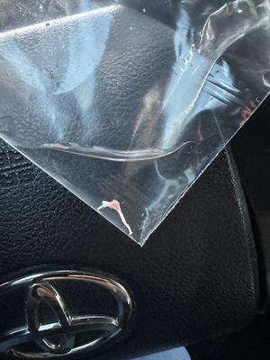 nerve removed from tooth