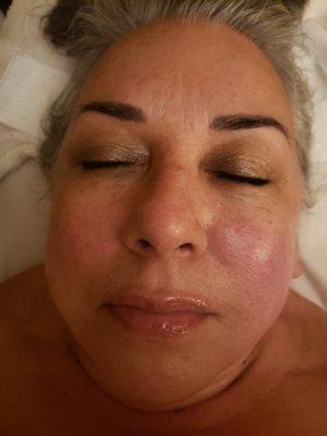 Nice rosy after glow!