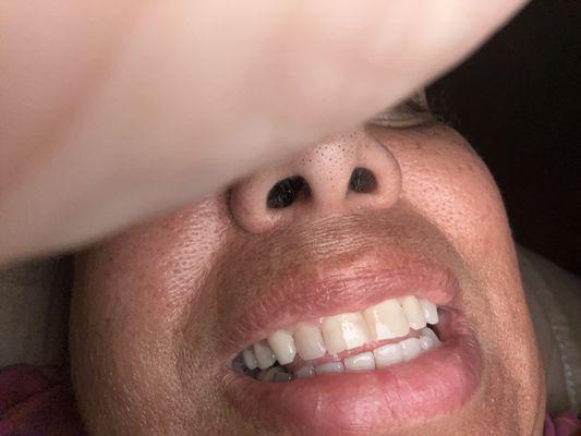 Panther Creek Dental of Frisco