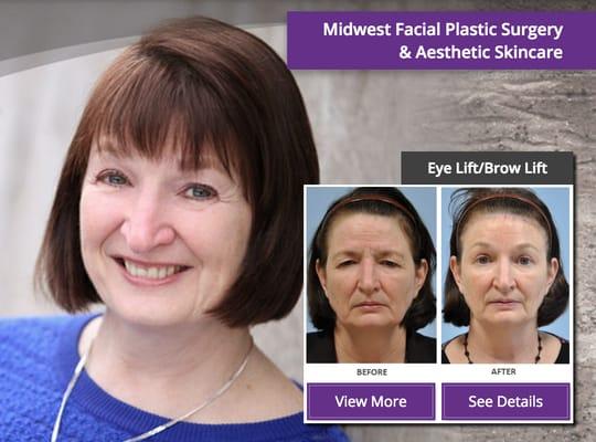 Midwest Facial Plastic Surgery & FACE Cosmetic Skincare