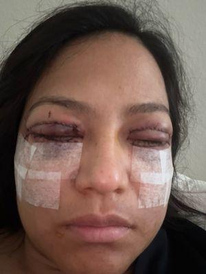 Skinzone Medical: Hannah Vu, MD