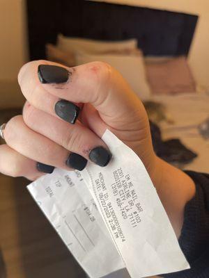 ZOOM IN. They are soooo bad.