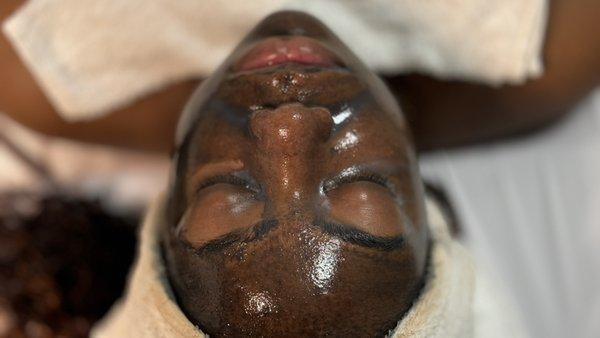 Acne clarifying treatment