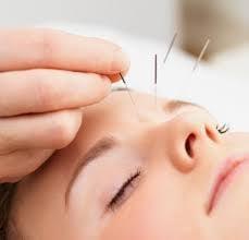Giordano Acupuncture