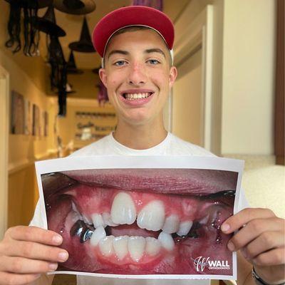 Wall Orthodontics