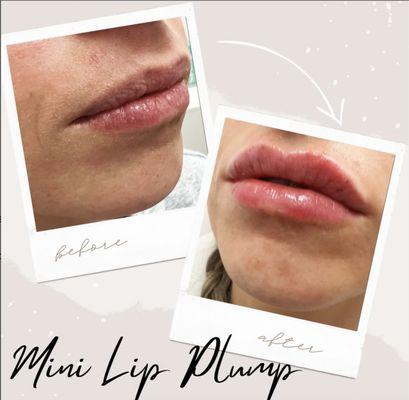 Mini Lip Plump