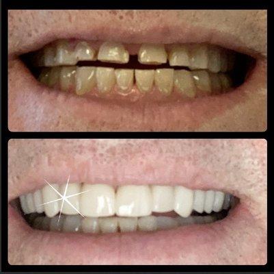 Alice Dellisanti, DDS