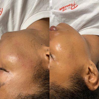 Bragg About It Aesthetics