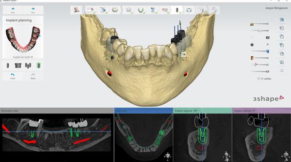 Digital Dentistry Trudentallab.net