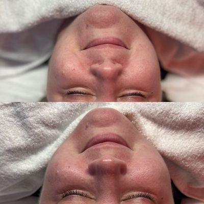 Glowhemian Esthetics