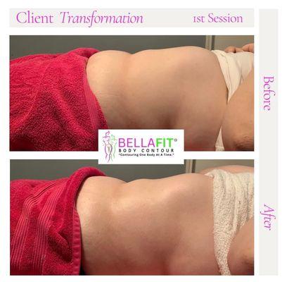 Cavitation Session #1: Client was sensitive to wood therapy but overall did great for her first session.