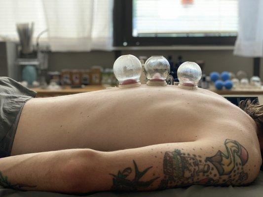 Treating the Root Acupuncture