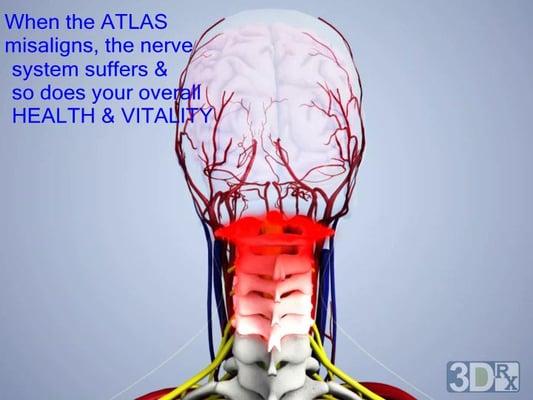 Head and neck pain is often the result of atlas subluxation (spinal misalignment). We can help! Gentle and specific corrections