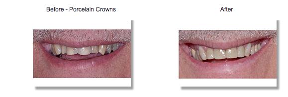 Phillip W. Wallace, DDS