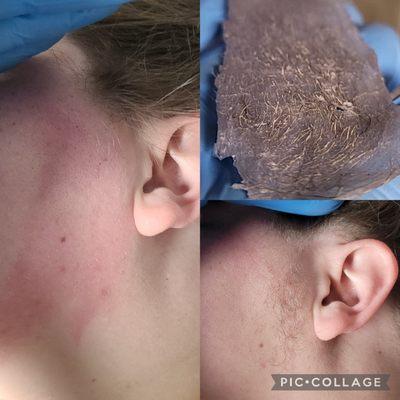 Pcos friendly facial waxing