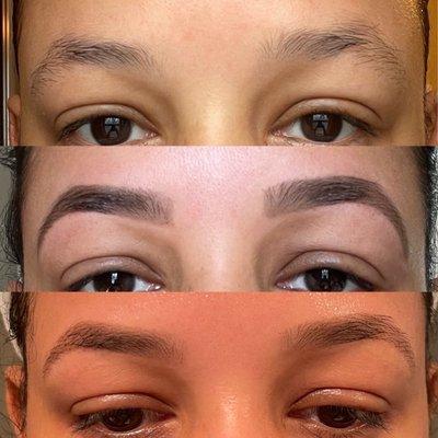 Top - before Middle - immediately after Bottom - 5 days later