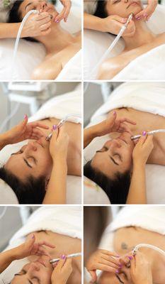 Microdermabrasion