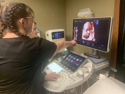 Advocate Ultrasound Solutions