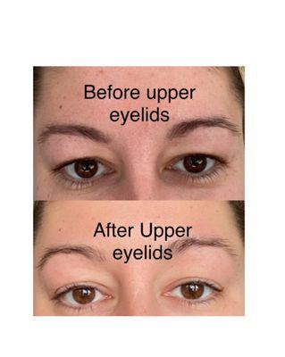 The Fibroblast Parlor