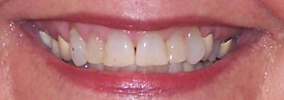 Andrew Gazerro III, DMD