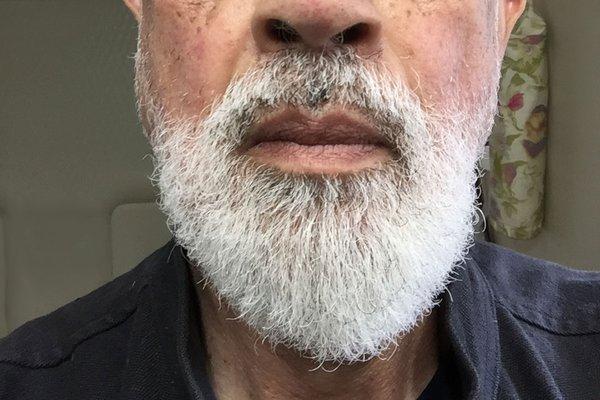 Lopsided beard, or my imagination?