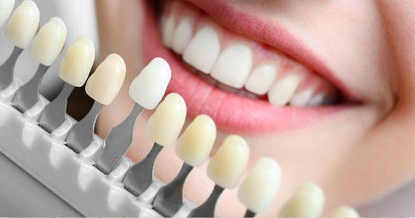 Whiter Teeth Up to 8 Shades