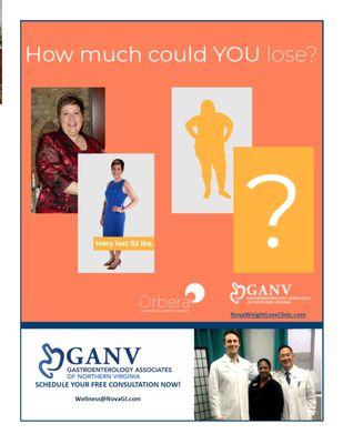 ORBERA Intragastric balloons help patients feel full while learning lifestyle modifications. Call 703-776-1777 to learn more!