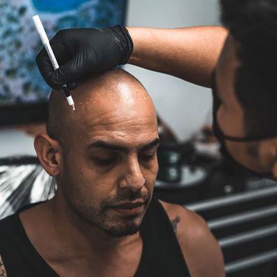 Revolution Scalp Micropigmentation