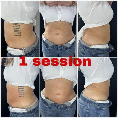 After just ONE session of T shape 2