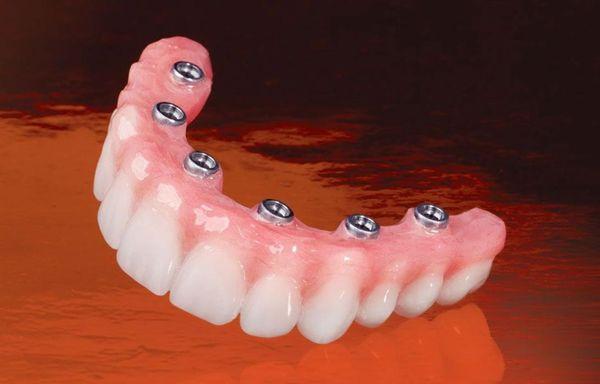 Ohana Dental Implant Centers