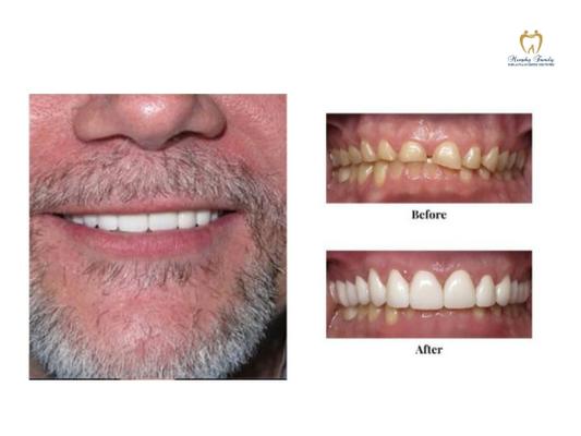 Best Dentist in Murphy, TX | Murphy Family Implant and Cosmetic Dentistry
Address: 601 W Farm To Market 544 Ste 108, Murphy, TX 75094