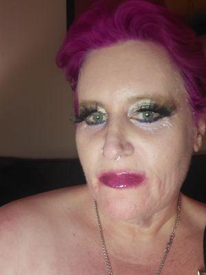 I Botox on my forehead and between my brows. Results so good that I just got it around my mouth. Not even totally filled in yet and look!