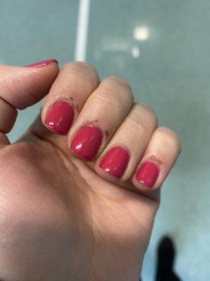 My cuticles were literally punctured!
