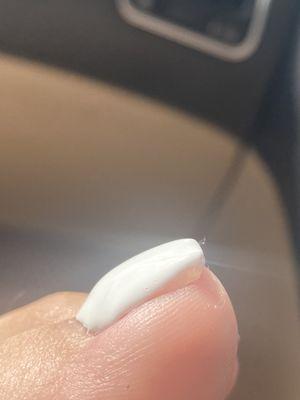 acrylic overlay on big toe side view