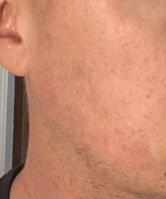 Glendale Dermatology