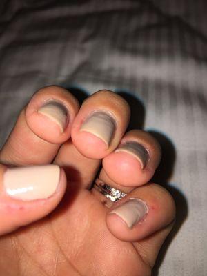 Yellow only 8 hours after getting this horrible manicure!