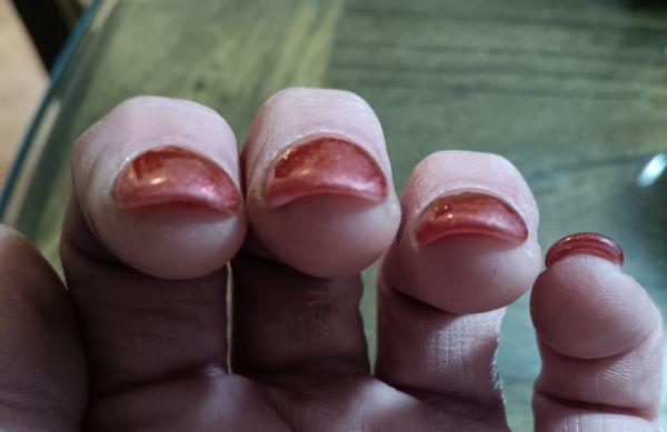 super thick and UGLY