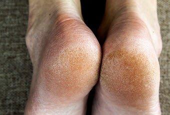 All South Bay Footcare - Torrance Podiatrist