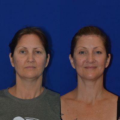 Egozi Plastic Surgery