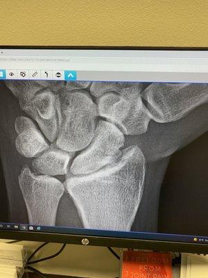Advanced Orthopaedic Specialists