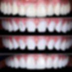 Emergency Dentist North Miami Beach